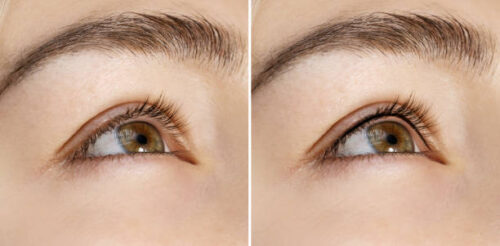 PMU infralash liner wimperopvulling