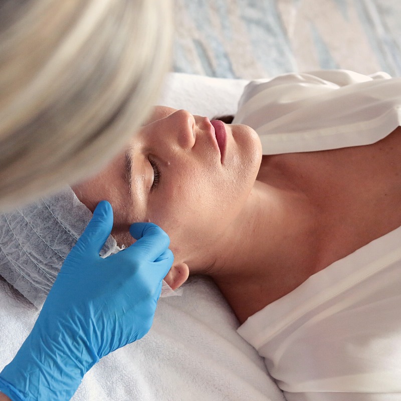 microneedling dermapen4 master