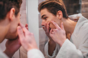 acne puistjes ontstekingen gezicht