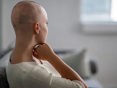 Alopecia behandelingen