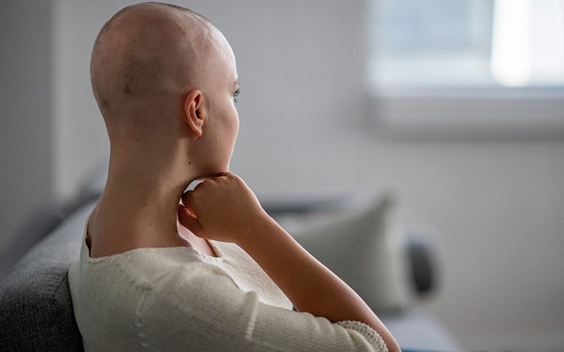 Alopecia behandelingen