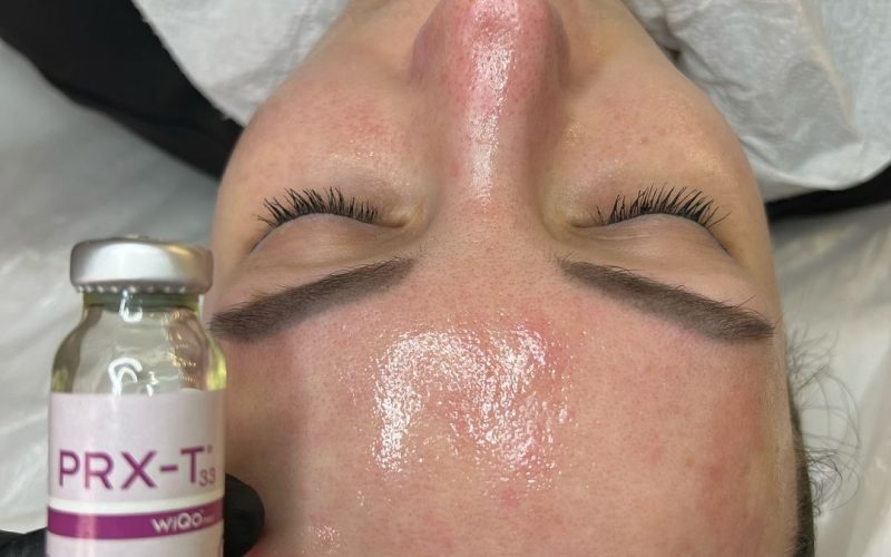 Huidverbeterende behandelingen in Lochem: PRX, microneedling, DAS Plasma, acne therapie en huidverjonging op maat. Ervaar professioneel resultaat bij Schoonheidssalon Bianca Lochem