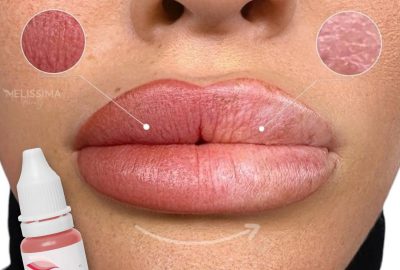 bijwerken lippen