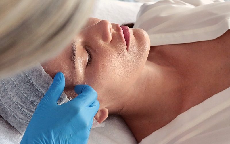 microneedling dermapen4 master